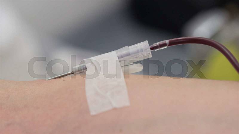 Donor in an armchair donates blood at hemotransfusion station, close-up, stock photo