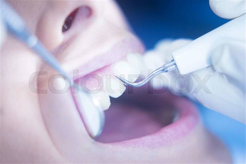 Dentist examining patient mouth in dental exam with dentist's instrumentation in clinic, stock photo