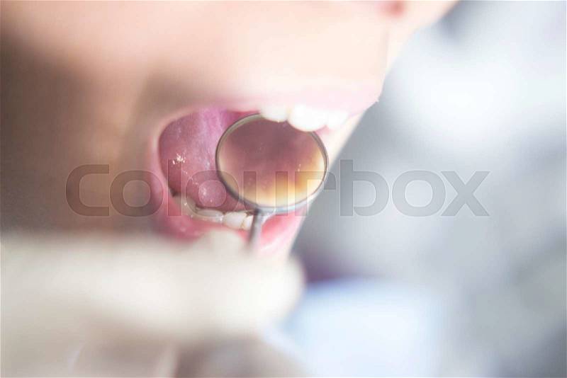 Dentist examining patient mouth in dental exam with dentist\'s instrumentation in clinic, stock photo