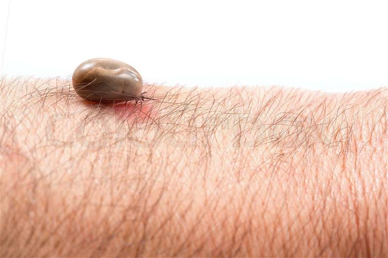 Tick on hand in human skin, red spots indicate infection, stock photo