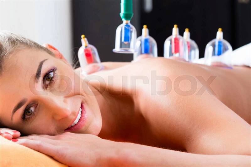 Woman in alternative medical cupping therapy with cups being applied on her back, stock photo
