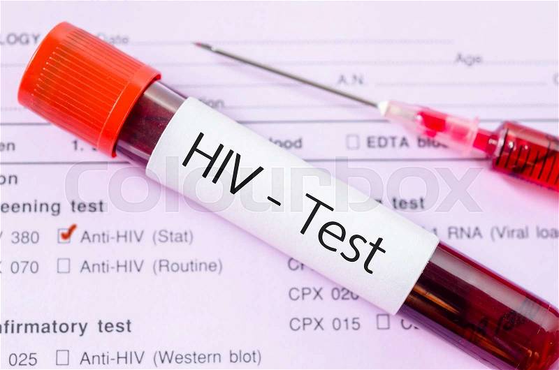 Sample blood collection tube with HIV test label on HIV infection screening test form, stock photo