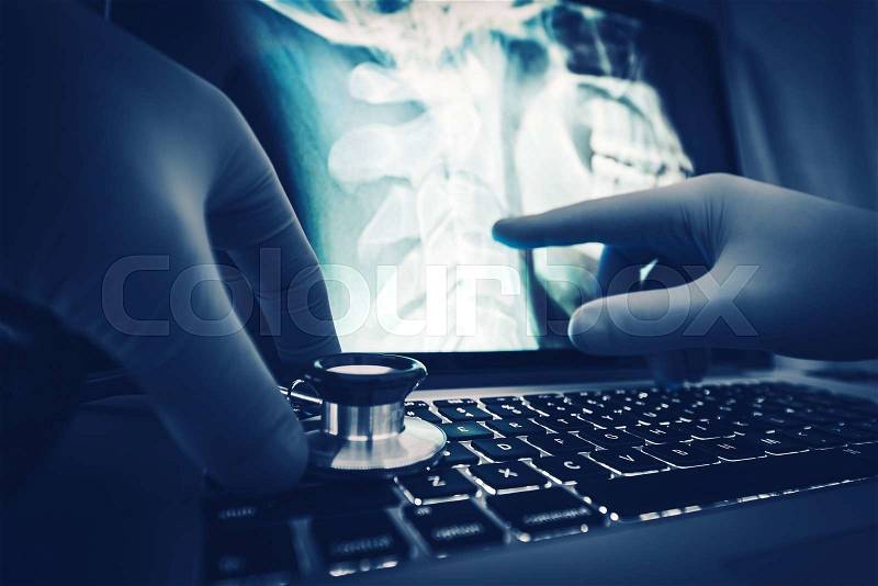 Doctor Xray Imagery Examination on the Laptop Computer. , stock photo