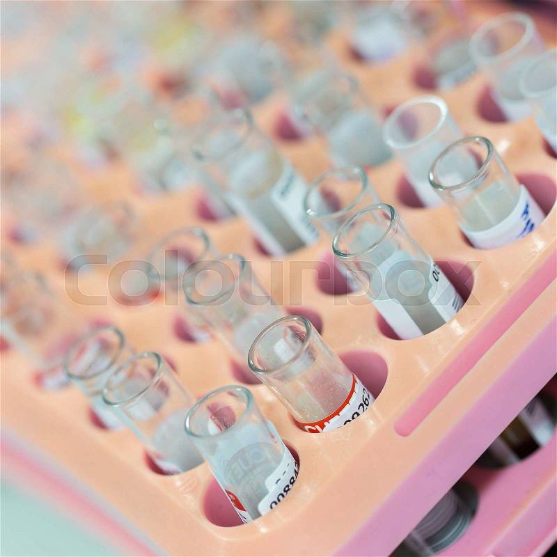 Several Test tubes sit in rack at laboratory, stock photo