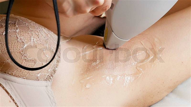 Woman gets laser hair removal treatment underarm. Modern permanent epilation procedure, stock photo