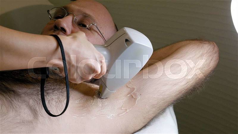 Man gets laser hair removal treatment underarm. Modern permanent epilation procedure, stock photo