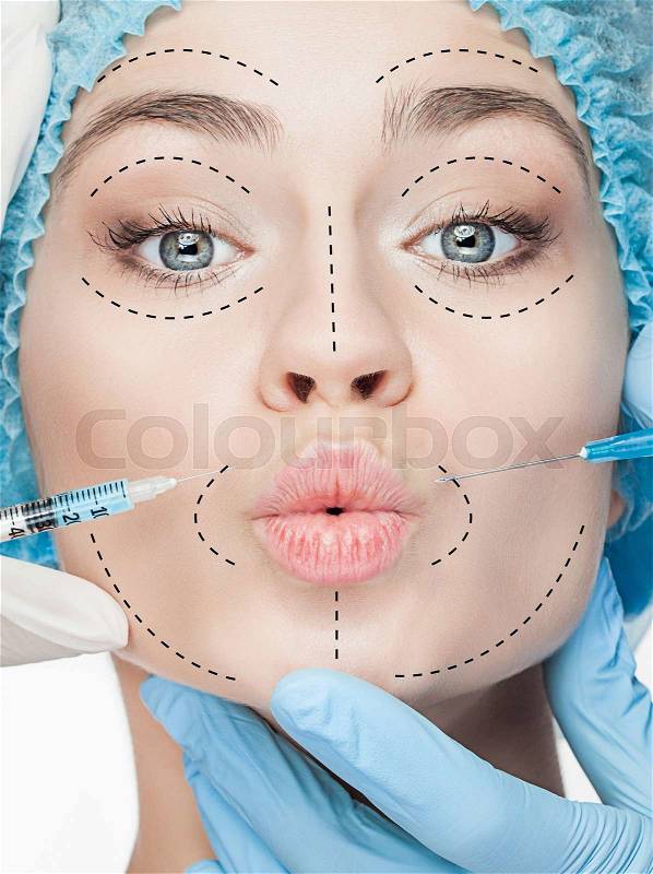 The beautiful female face with lines during plastic surgery operation of cosmetology, stock photo