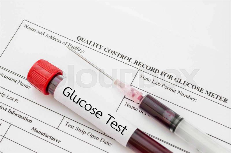 Sample blood for screening diabetic test in blood tube on blood sugar control record, stock photo