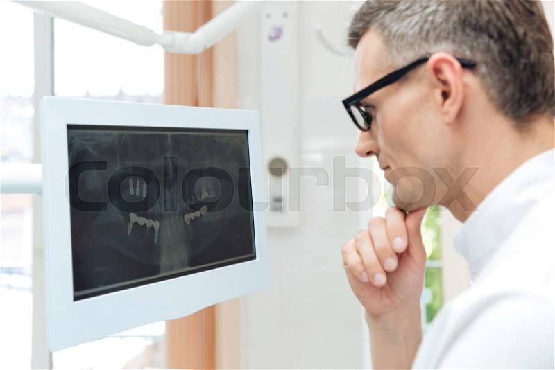 Male dentist looking teeth on digital X-Ray computer monitor wering glasses, stock photo