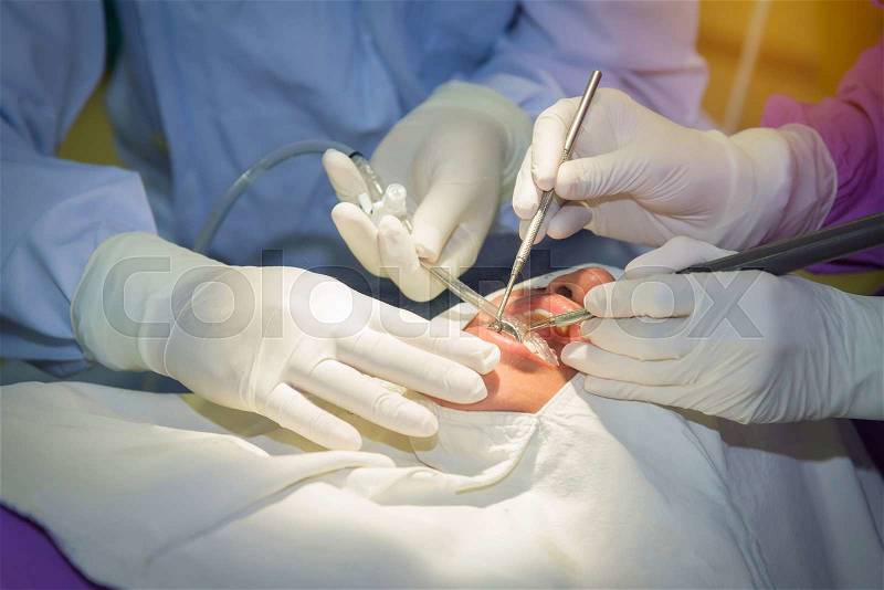The doctor cleaning the teeth patient with ultrasonic tool, stock photo