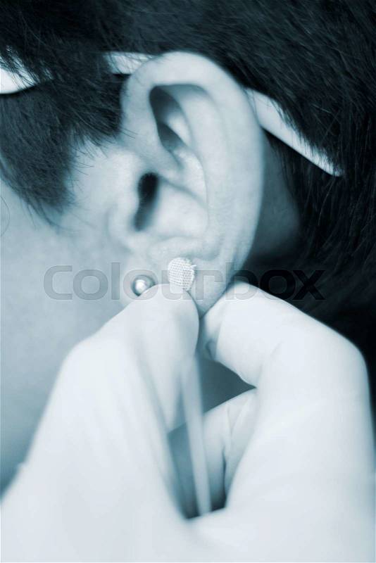 Auriculartherapy oriental acupunture ear seed sticker plaster auriculatherapy treatment physiotherapy. Physiotherapist in hospital clinic,, stock photo