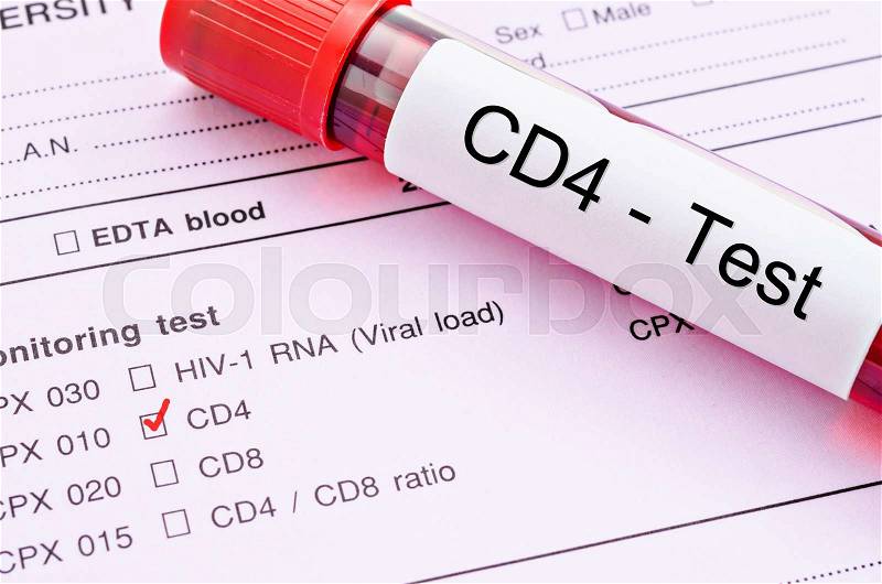 Red mark and Blood sample in tube for CD4 cell testing, Immunology cell in HIV infected people on request form background, stock photo