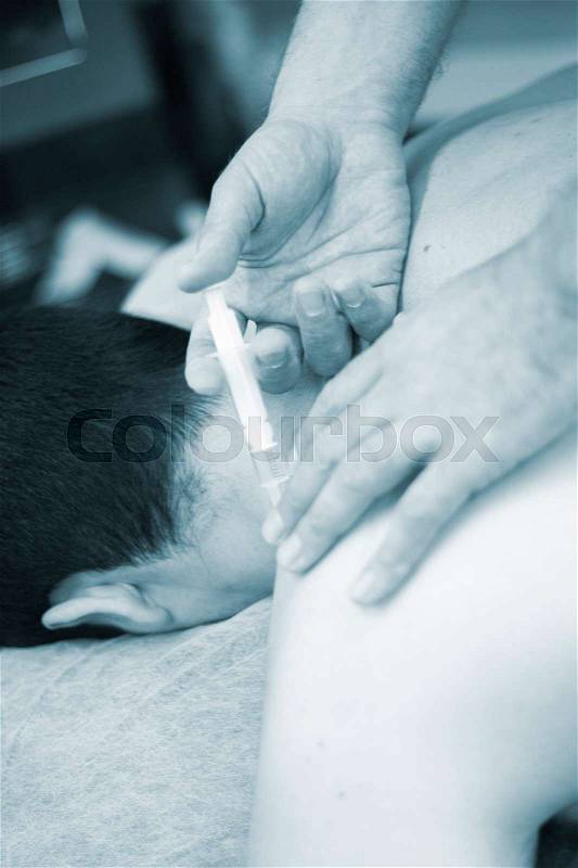 Intratissue Percutaneous Electrolysis EPI with needle injection medical procedure by physiotherapist doctor and patient in clinic, stock photo