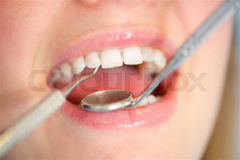 During dental checkup, stock photo