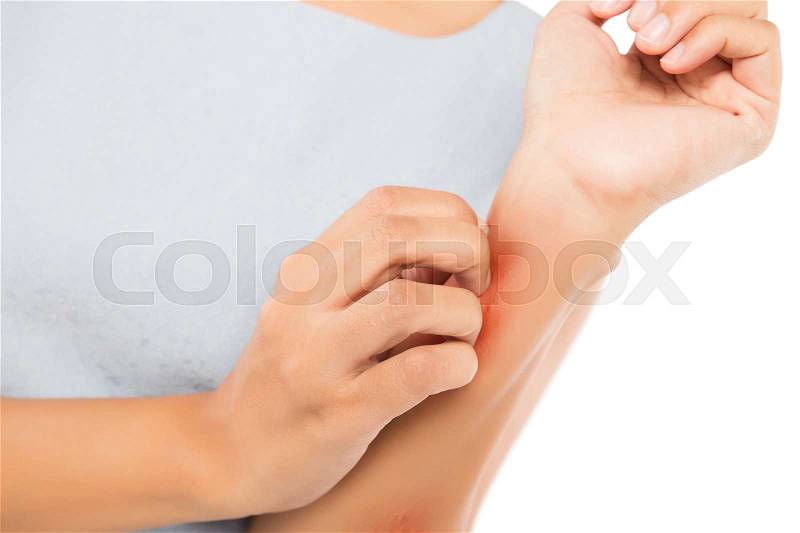 Girl scratch the itch with hand, Arm, Itching, Concept with Healthcare And Medicine, stock photo