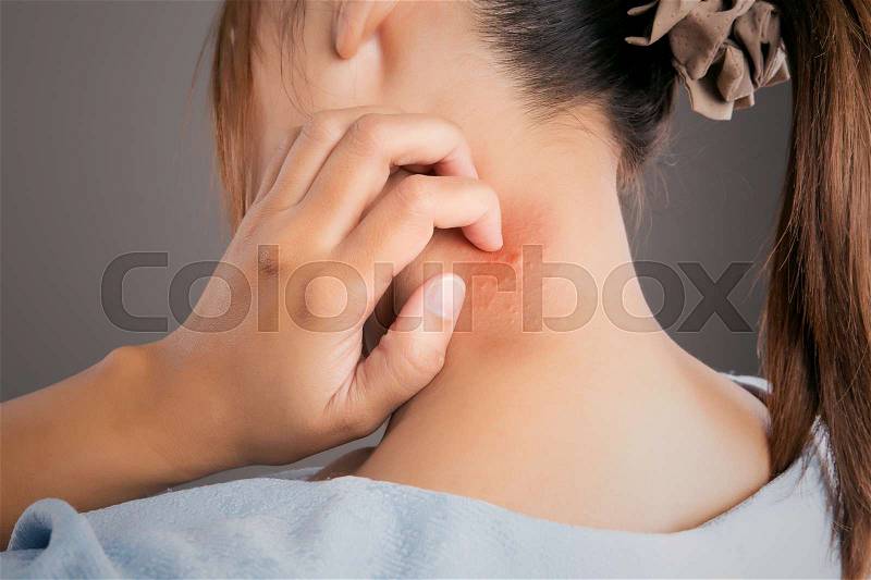 Woman scratch the itch with hand ,Neck, itching, Concept with Healthcare And Medicine, stock photo