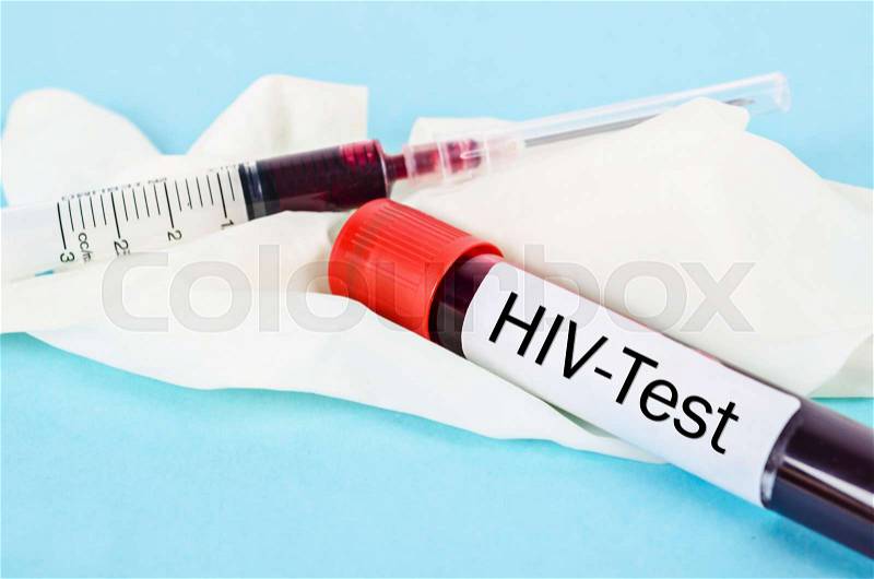 Sample blood for screening test for HIV test and syringe on glove in laboratoly, stock photo