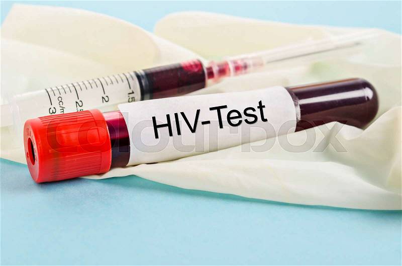 Sample blood for screening test for HIV test and syringe on glove in laboratory, stock photo
