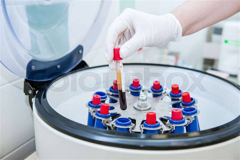 Doctor hand in medical glove with clinical chemistry samples putting them to centrifuge, stock photo