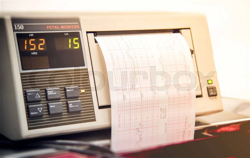 Close up of monitor printout in delivery room tracking baby heartbeat and contractions, stock photo