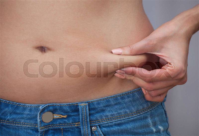 She pulls the hand skin showing fat in the abdomen and flanks. Treatment and disposal of excess weight, the deposition of subcutaneous fat tissue, stock photo