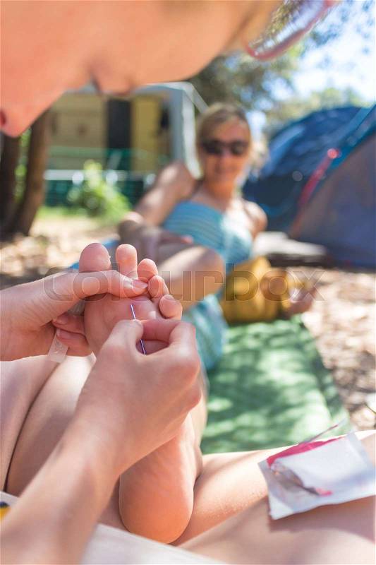 Woman taking spine out of her friends sole using medical needle after she stepped on sea urchin on summer vacations. Improvised domestic first aid, stock photo