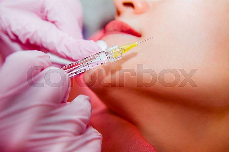 Close up hands of cosmetologist making injection in face, lips. Young woman gets beauty facial injections in clinic. Face aging, rejuvenation and hydration procedures. Aesthetic cosmetology. Selective focus, stock photo