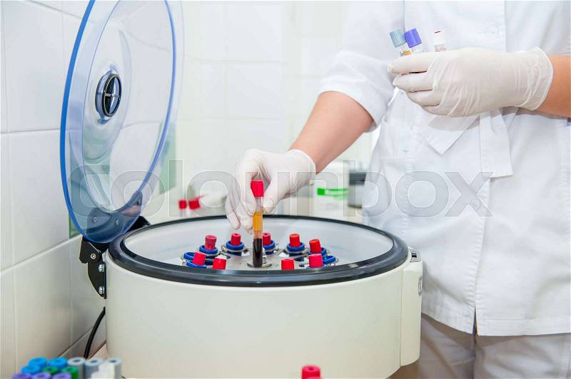 Doctor hand in medical glove with clinical chemistry samples putting them to centrifuge, stock photo