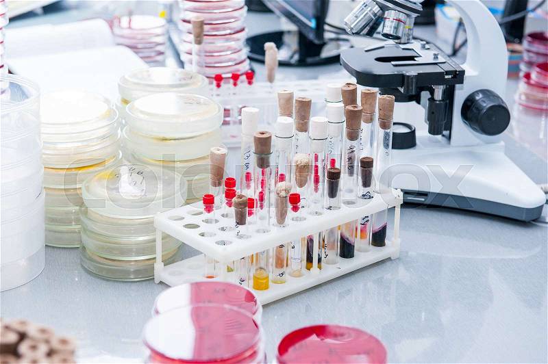Details of microbiology laboratory; Petri dishes for bacteria growing, tubes, microscope and oher. Selective focus, stock photo