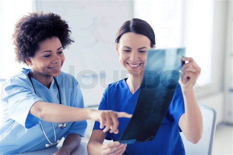Radiology, surgery, people and medicine concept - happy female doctors looking to and discussing x-ray image at hospital, stock photo