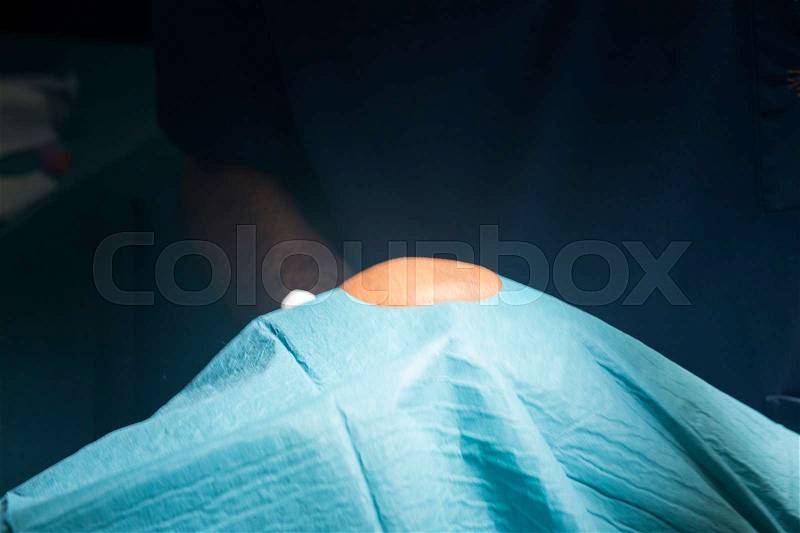Preparing knee for surgery hospital operation medical procedure in emergency room operating theater, stock photo