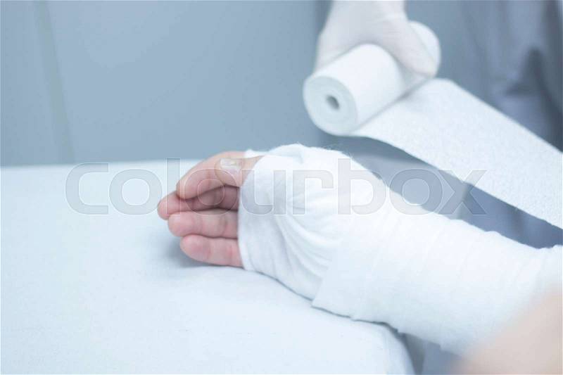 Doctor applying a plaster cast and bandages to patient forearm and wrist to immobilize after fracture injury, stock photo