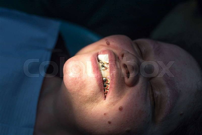 The dentist works with the client in the clinic , stock photo