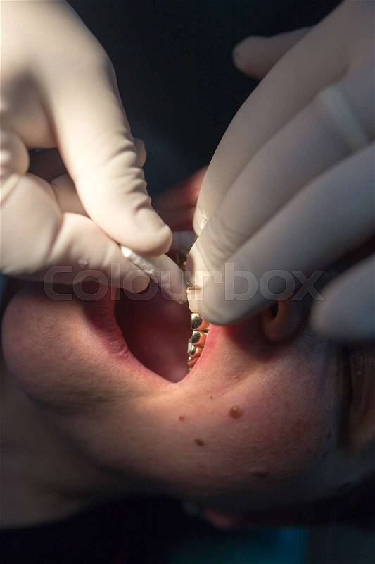 The dentist works with the client in the clinic , stock photo