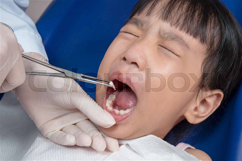 Asian Chinese little girl lying down for tooth extraction at dental clinic, stock photo