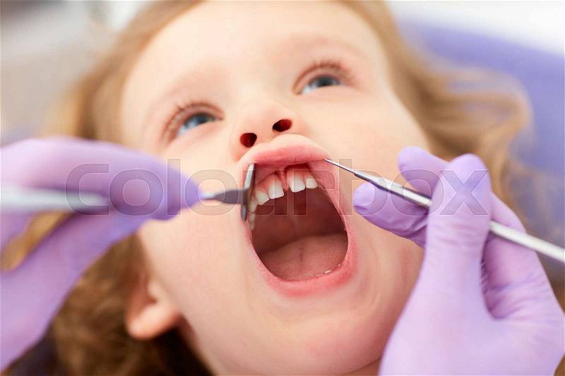 Hands of unrecognizable pediatric dentist holding lip up and making examination of cute little girl lying with mouth opened in chair in a clinic, stock photo