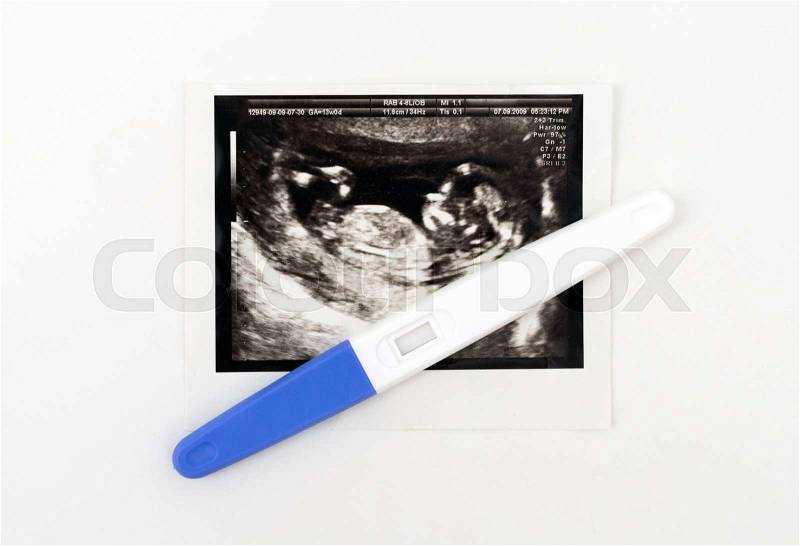 Plastic pregnancy test and ultrasound picture, stock photo