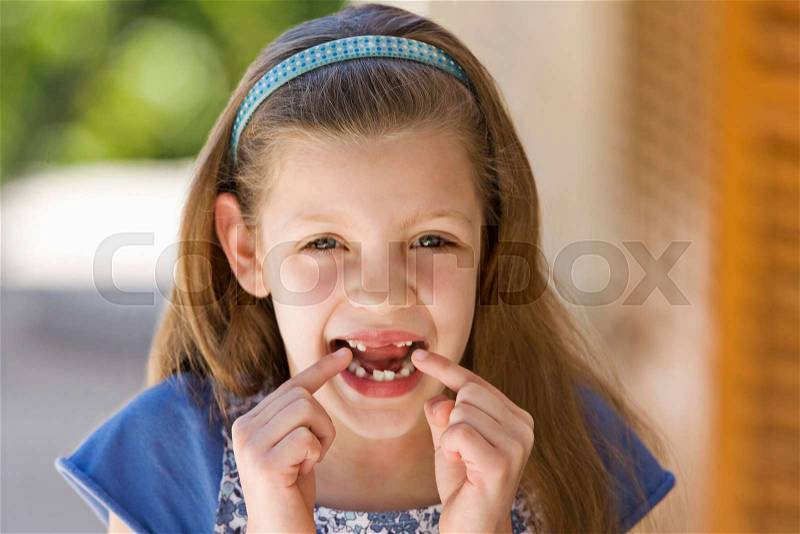 A young girl points to her missing teeth, stock photo