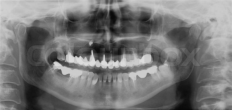Jaw and facial surgery
