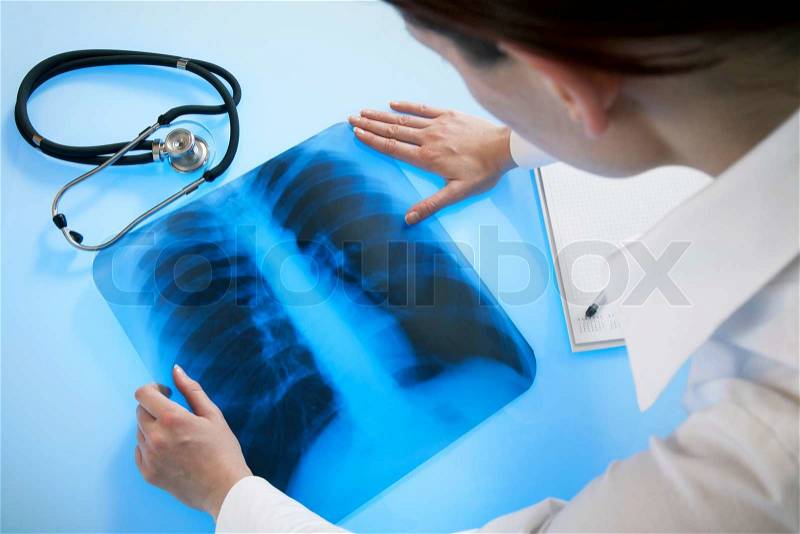 Doctor examines x-ray image of lungs lying on the light table, stock photo