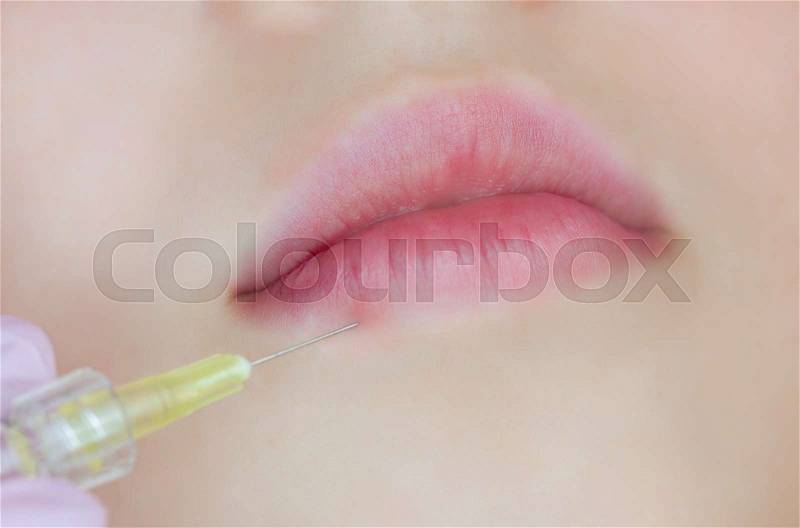 The doctor cosmetologist makes Lip augmentation procedure of a beautiful woman in a beauty salon.Cosmetology skin care, stock photo