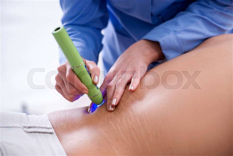 Patient in clinic undergoing laser scar removal, stock photo