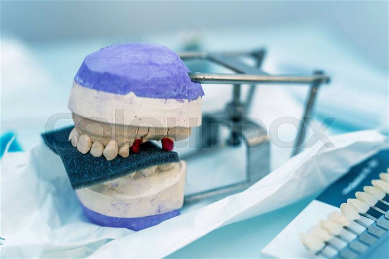Prosthetic teeth organized on a white and purple support base isolated on a dentist room, stock photo
