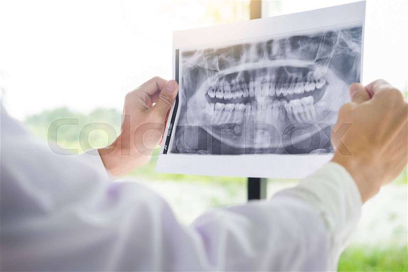 Panoramic dental X-ray of a human jaw holding in the hands of the dentist, stock photo