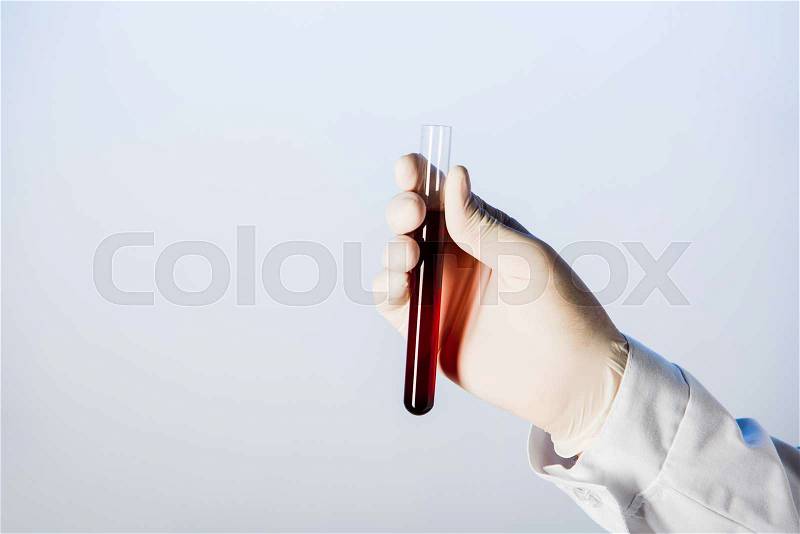Partial view of doctor in medical glove holding test tube with blood , stock photo