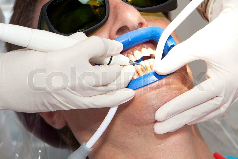 Visit to the dentist Dentist at work in dental room, stock photo