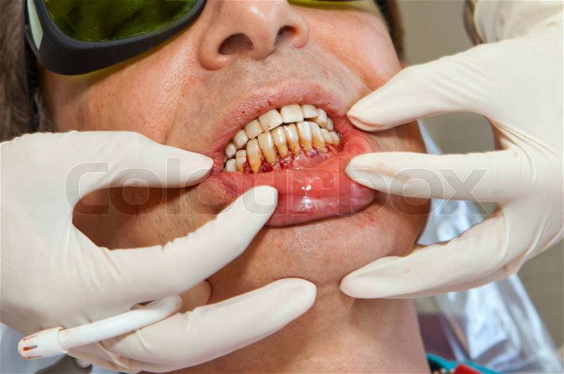 Visit to the dentist Dentist at work in dental room, stock photo