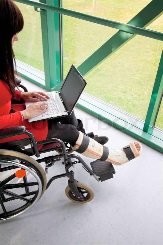 Woman with broken leg, stock photo