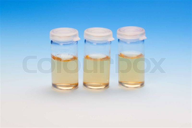 Three liquid samples in plastic vials. biological laboratory, stock photo