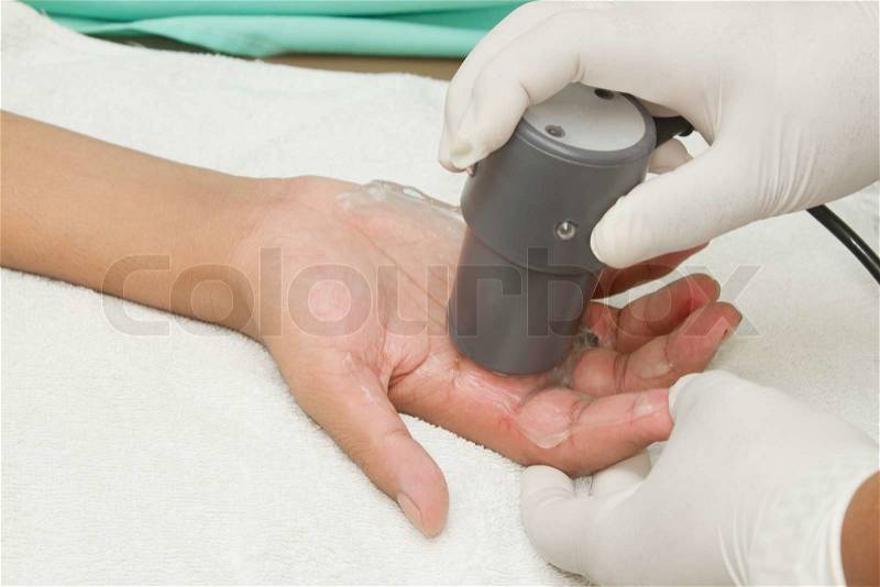 Physiotherapist is applying ultrasound therapy on the hand with ultrasound head transducer. Medical equipment use for release pain, stock photo